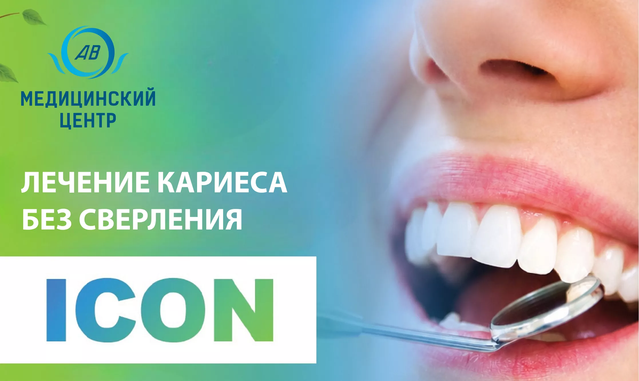 Технология ICON (Айкон).